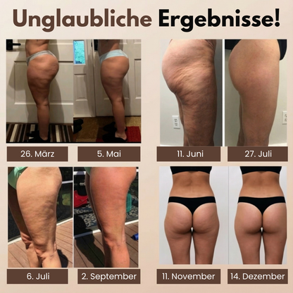 3D Anti-Cellulite Short-Leggings