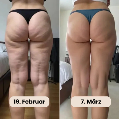 3D Anti-Cellulite Short-Leggings